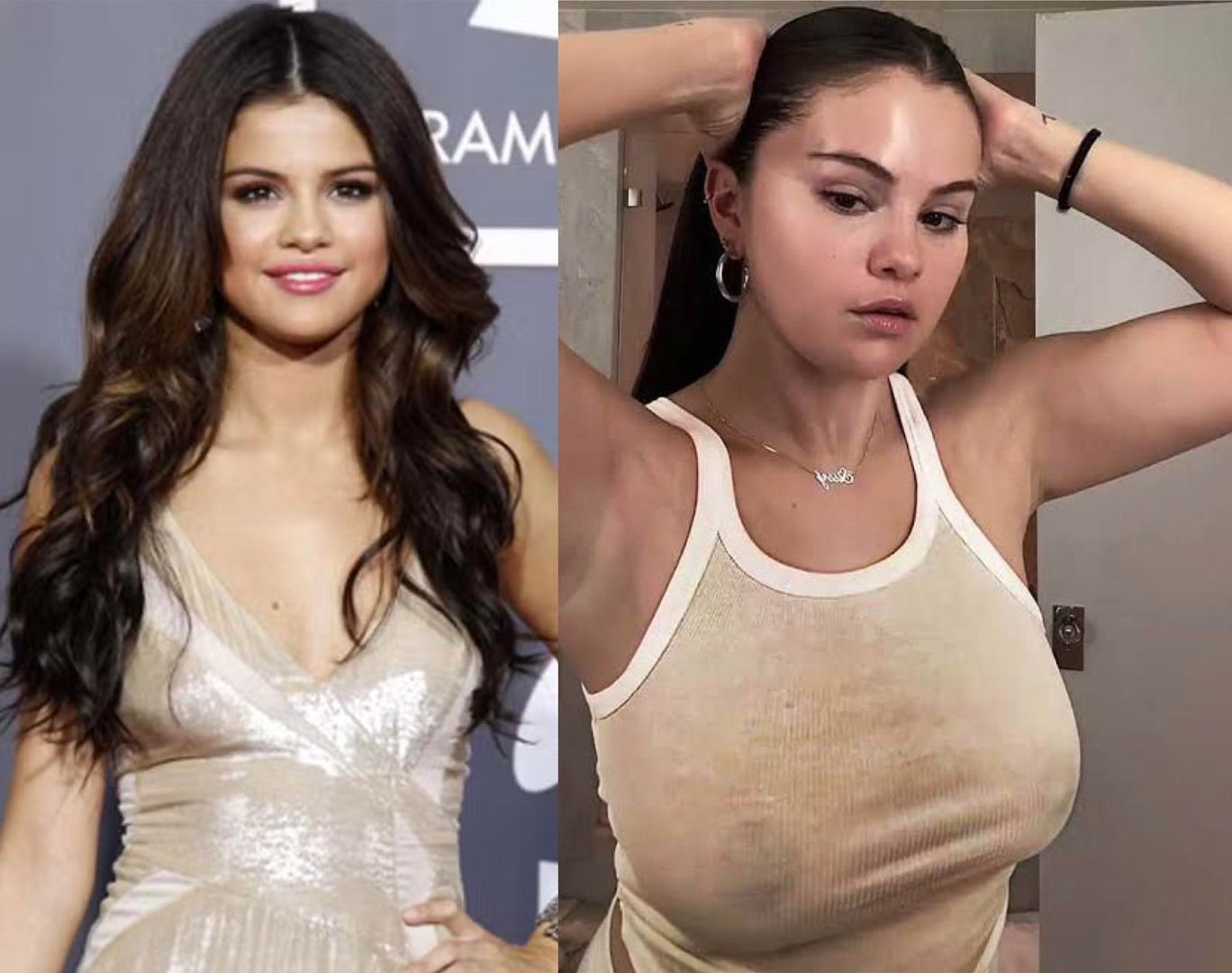Selena Gomez Breast Implants Before And After